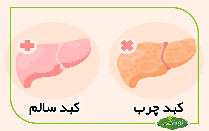 کبد چرب چیست؟