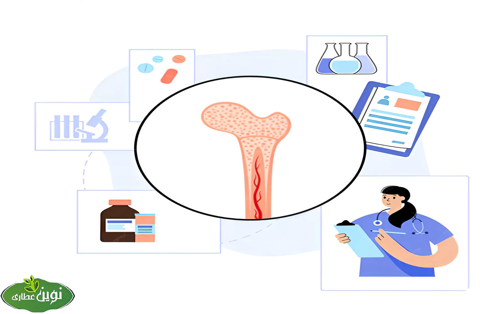 تصویر مرتبط با درمان پوکی استخوان