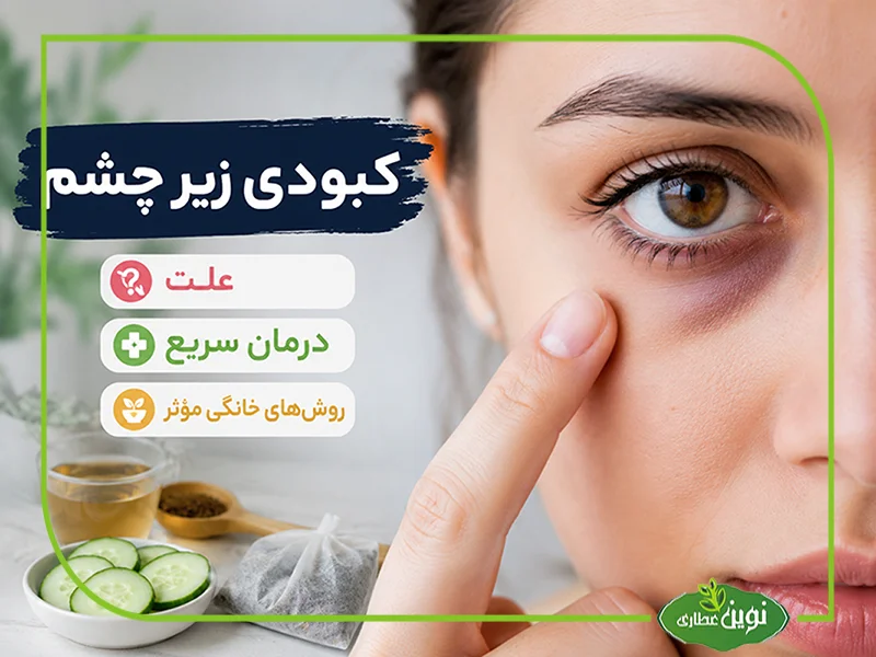 کبودی زیر چشم